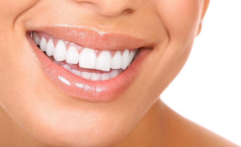 Teeth-whitening